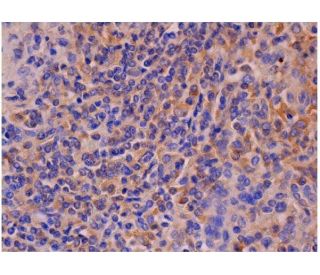 plexin-A3 Antibody (A-8) - Immunohistochemistry - Image 287233 