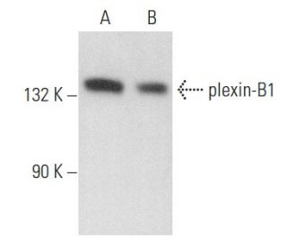 plexin-B1 Antibody (H-300): sc-25642
