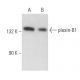 Dieser polyklonale Antikörper wird nicht mehr hergestellt. Wir empfehlen Ihnen unseren <a href="plexin-b1-antibody-a-8">plexin-B1 (A-8)</a> monoklonalen Antikörper (Beispielsdaten werden angezeigt). western blotting image from recommended plexin-B1 (A-8) monoclonal antibody replacement. Image 357242