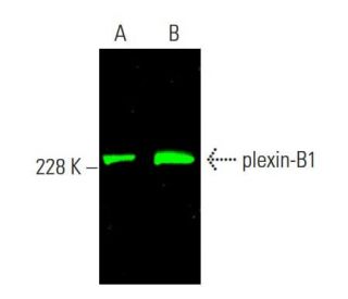 plexin-B1 Antibody (A-8) - Western Blotting - Image 385408
