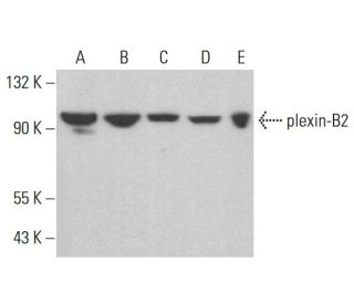 plexin-B2 Antibody (H-12) - Western Blotting - Image 375398