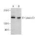 This polyclonal antibody has been discontinued. See our recommended <a href="plexin-c1-antibody-b-8">plexin-C1 (B-8)</a> monoclonal antibody (sample data shown). western blotting image from recommended plexin-C1 (B-8) monoclonal antibody replacement. Image 382360