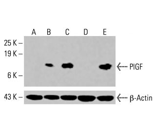 PlGF Antibody (H-4) - Western Blotting - Image 416150Each CRISPR/Cas9 Knockout (KO) Plasmid product consists of a pool of 3 plasmids designed to ensure identification and cleavage of a specific gene for maximum knockout efficiency. Each plasmid encodes a unique 20 nt sequence derived from the GeCKO (v2) library.
