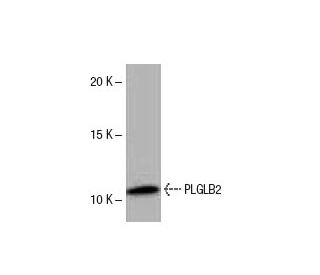 PLGLB2 Antibody (62.P) - Western Blotting - Image 53883 