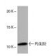 PLGLB2 Antibody (62.P) - Western Blotting - Image 53883 