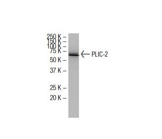 PLIC-2 Antibody (QR-2) - Western Blotting - Image 33983The Double Nickase Plasmid features a U6 promoter for sgRNA expression, a 20 nt targeting sequence, and a gRNA scaffold to guide Cas9n. It includes a CBh promoter for Cas9n (D10A) and puromycin resistance, GFP for transfection verification, and nuclear localization signals (NLS). The 2A peptide allows co-expression of Cas9n and Puro from a single promoter, enabling precise genome editing with reduced off-target effects.