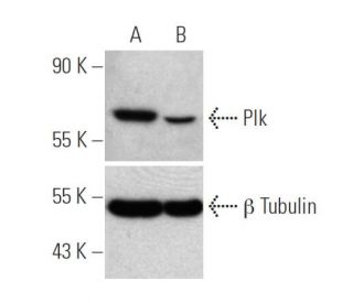 Plk siRNA (h): sc-36277. Western blot analysis of Plk expression in non-transfected control (A) and Plk siRNA transfected 