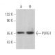 PLRG1 Antibody (B-7) - Western Blotting - Image 369460 