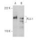 PLU-1 Antibody (7H3D7) - Western Blotting - Image 368286