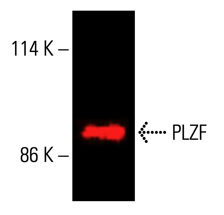 PLZF抗体(D-9) | SCBT - Santa Cruz Biotechnology