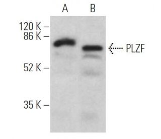 western blotting image from recommended PLZF (D-9) monoclonal antibody replacement. Image 361842