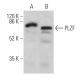 western blotting image from recommended PLZF (D-9) monoclonal antibody replacement. Image 361842