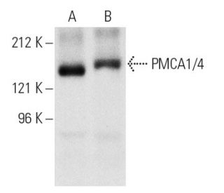 PMCA1/4 Antibody (5F10) - Western Blotting - Image 4603 
