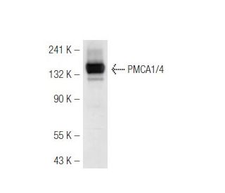 PMCA1/4 Antibody (6D131) - Western Blotting - Image 49006 