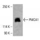 Anticorps PMCA1 (F-10): sc-398413. Analyse par Western blot de l'expression de PMCA1 dans un lysat cellulaire complet de HeLa. Réactif de détection utilisé: m-IgG Fc BP-HRP: sc-525409. PMCA1 Antibody (F-10) - Western Blotting - Image 415443