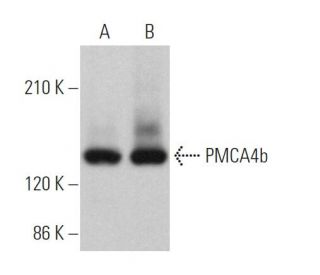 PMCA4b Antibody (2T2) - Western Blotting - Image 364534 