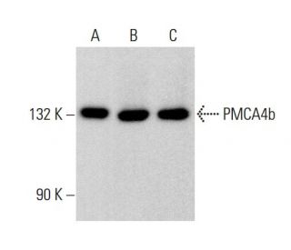 PMCA4b Antibody (3F18) - Western Blotting - Image 383203 