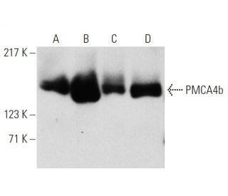 PMCA4b Antibody (JA3) - Western Blotting - Image 4604 