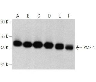 PME-1 Antibody (F-11) - Western Blotting - Image 358637 