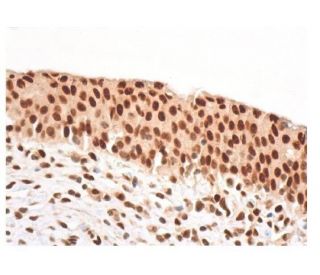 PML Antibody (5G191) - Immunohistochemistry - Image 352933 