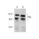 Este anticorpo policlonal foi descontinuado. Consulta o nosso anticorpo monoclonal <a href="pml-antibody-e-11">PML (E-11)</a> recomendado (dados de amostra apresentados). western blotting image from recommended PML (E-11) monoclonal antibody replacement. Image 375506