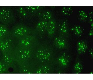 PML Antibody (PG-M3) - Immunofluorescence - Image 370906 