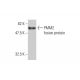 PMM2 Antibody (2A5) - Western Blotting - Image 348570