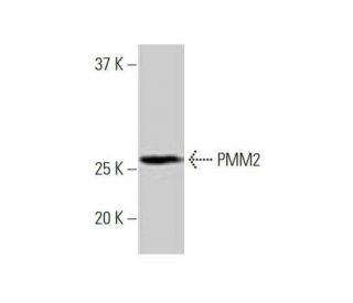 PMM2 Antibody (2A5) - Western Blotting - Image 352130Each CRISPR/Cas9 Knockout (KO) Plasmid product consists of a pool of 3 plasmids designed to ensure identification and cleavage of a specific gene for maximum knockout efficiency. Each plasmid encodes a unique 20 nt sequence derived from the GeCKO (v2) library.
