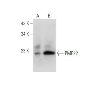 PMP22 Antibody (G-6) - Western Blotting - Image 344473The Double Nickase Plasmid features a U6 promoter for sgRNA expression, a 20 nt targeting sequence, and a gRNA scaffold to guide Cas9n. It includes a CBh promoter for Cas9n (D10A) and puromycin resistance, GFP for transfection verification, and nuclear localization signals (NLS). The 2A peptide allows co-expression of Cas9n and Puro from a single promoter, enabling precise genome editing with reduced off-target effects.
