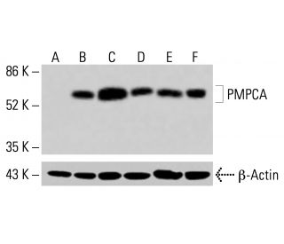 PMPCA Antibody (G-2) - Western Blotting - Image 415065