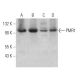 PMR1 Antibody (G-9) - Western Blotting - Image 369916 