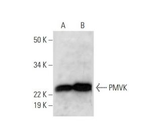 PMVK Antibody (H-9) - Western Blotting - Image 294399 