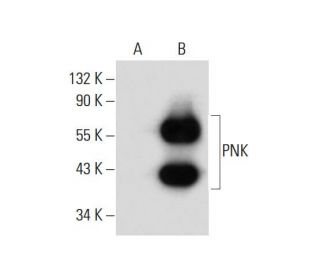 PNK Antibody (A-4) - Western Blotting - Image 134066 