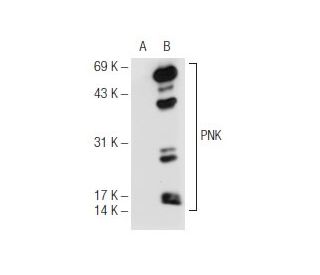 PNK Antibody (B-4) - Western Blotting - Image 68251