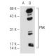 PNK Antibody (B-4) - Western Blotting - Image 68251