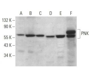 PNK Antibody (B-5) - Western Blotting - Image 359104 