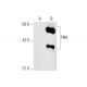 PNK Antibody (C-11) - Western Blotting - Image 66175