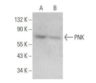 PNK Antibody (C-11) - Western Blotting - Image 359139 