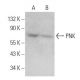 PNK Antibody (C-11) - Western Blotting - Image 359139 