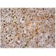 PNK Antibody (E-9) - Immunohistochemistry - Image 159959 