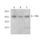 PNK Antibody (E-9) - Western Blotting - Image 359140 