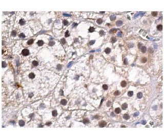 PNK Antibody (F-3) - Immunohistochemistry - Image 160234 