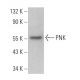 PNK Antibody (F-3) - Western Blotting - Image 364713