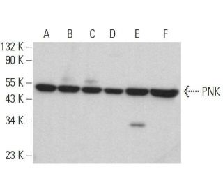 PNK Antibody (F-5) - Western Blotting - Image 359135 