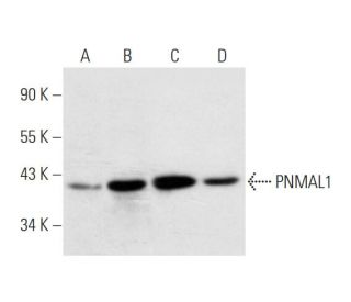PNMAL1 Antibody (A-2) - Western Blotting - Image 332747 