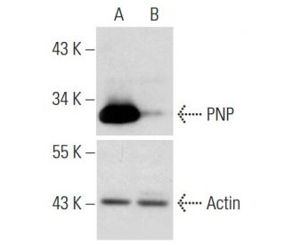 PNP shRNA Plasmid (h): sc-45991-SH. Western blot analysis of human PNP expression in PNP transfected (A) and PNP/PNP shRNA 