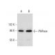 PNPase Antibody (A-4) - Western Blotting - Image 135767
