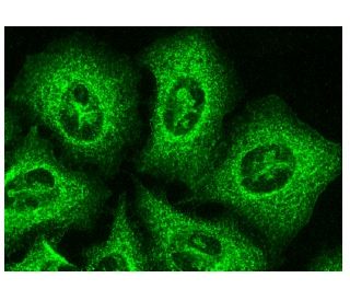 Podocalyxin-like 1 Antibody (3D3) | SCBT - Santa Cruz
