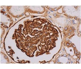 Podocalyxin-like 1 Antibody (3D3) | SCBT - Santa Cruz