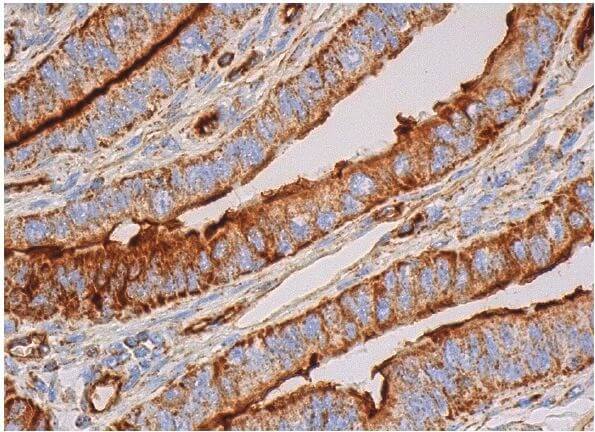Podocalyxin-like 1 Antibody (3D3) | SCBT - Santa Cruz